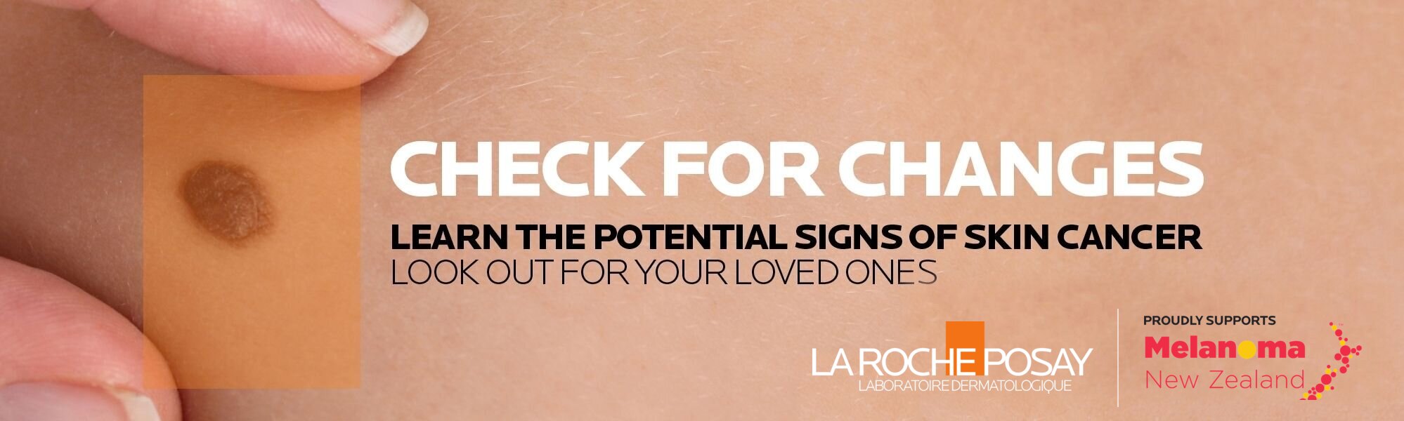 Check for changes. Learn the potential signs of skin cancer; look out for your loved ones. La Roche-Posay, proudly supporting Melanoma New Zealand.